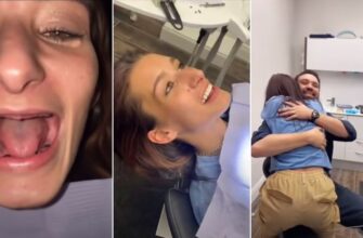 Искренние слезы радости девушки которая получила новые зубы 19